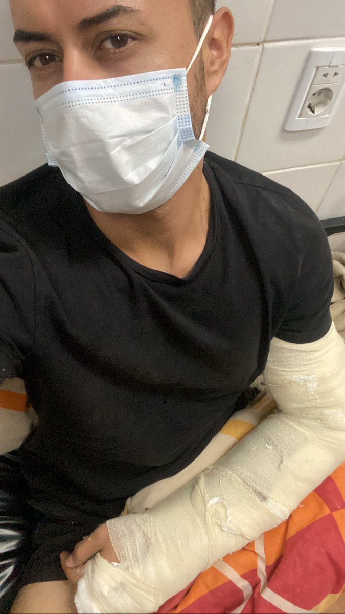 ral_acua's tweet photo. Hola gente! Hace 1 semana me chocaron y tengo una fractura en el brazo, debo ponerme platino y no logramos aún dar con el responsable y debo operarme lo antes posible! El próximo finde haré una actividad solidaria para recaudar fondos, desde ya agradezco la difusión! 🙏💪🏻🥹 https://t.co/UVnsSSOyE4