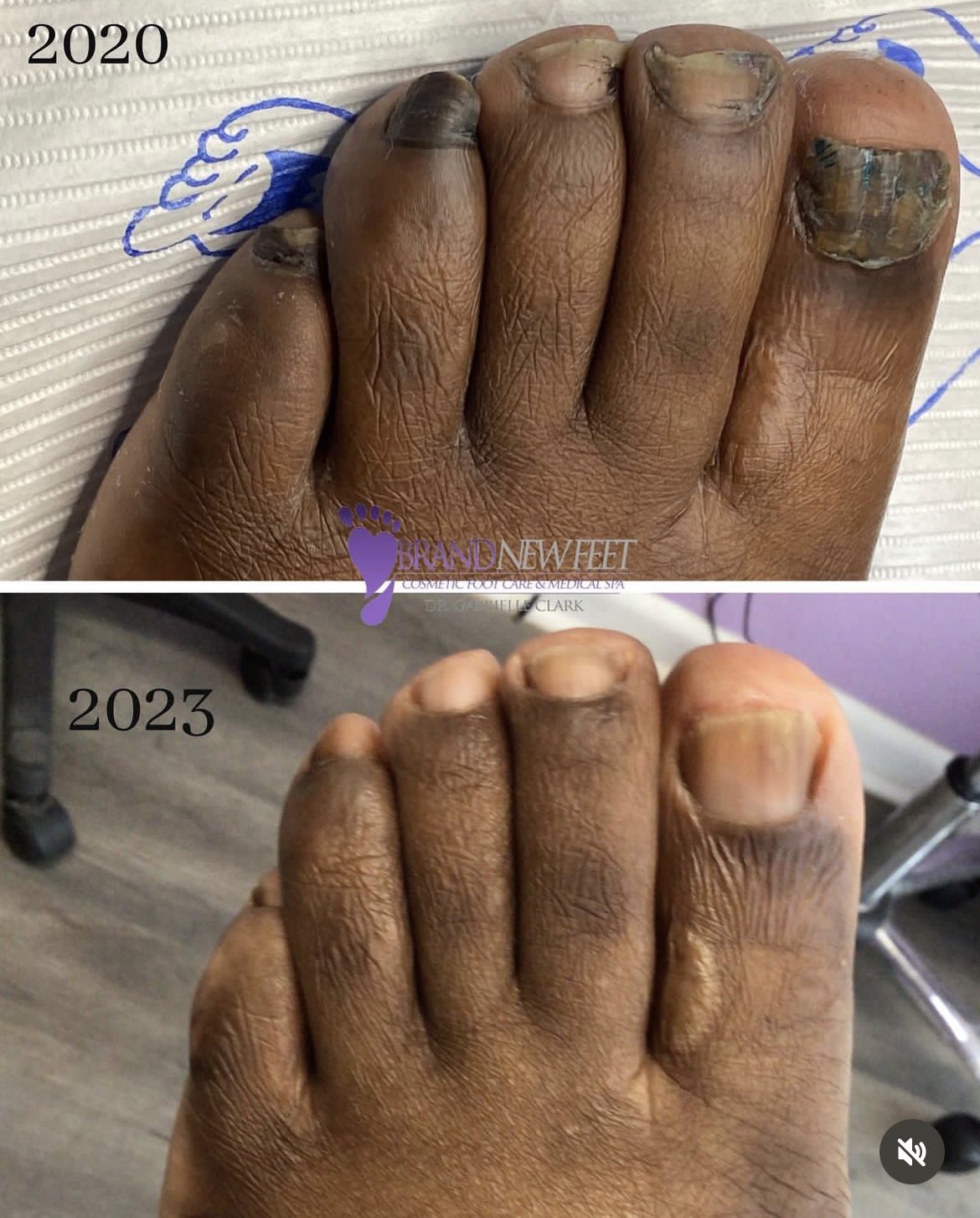 Latest foot cheap