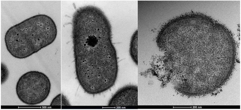 📌 Acinetobacter baumannii is considered by the Infectious Diseases Society of America as one of the “red alert” pathogens that significantly threaten the effectiveness of our current antibacterial armamentarium.