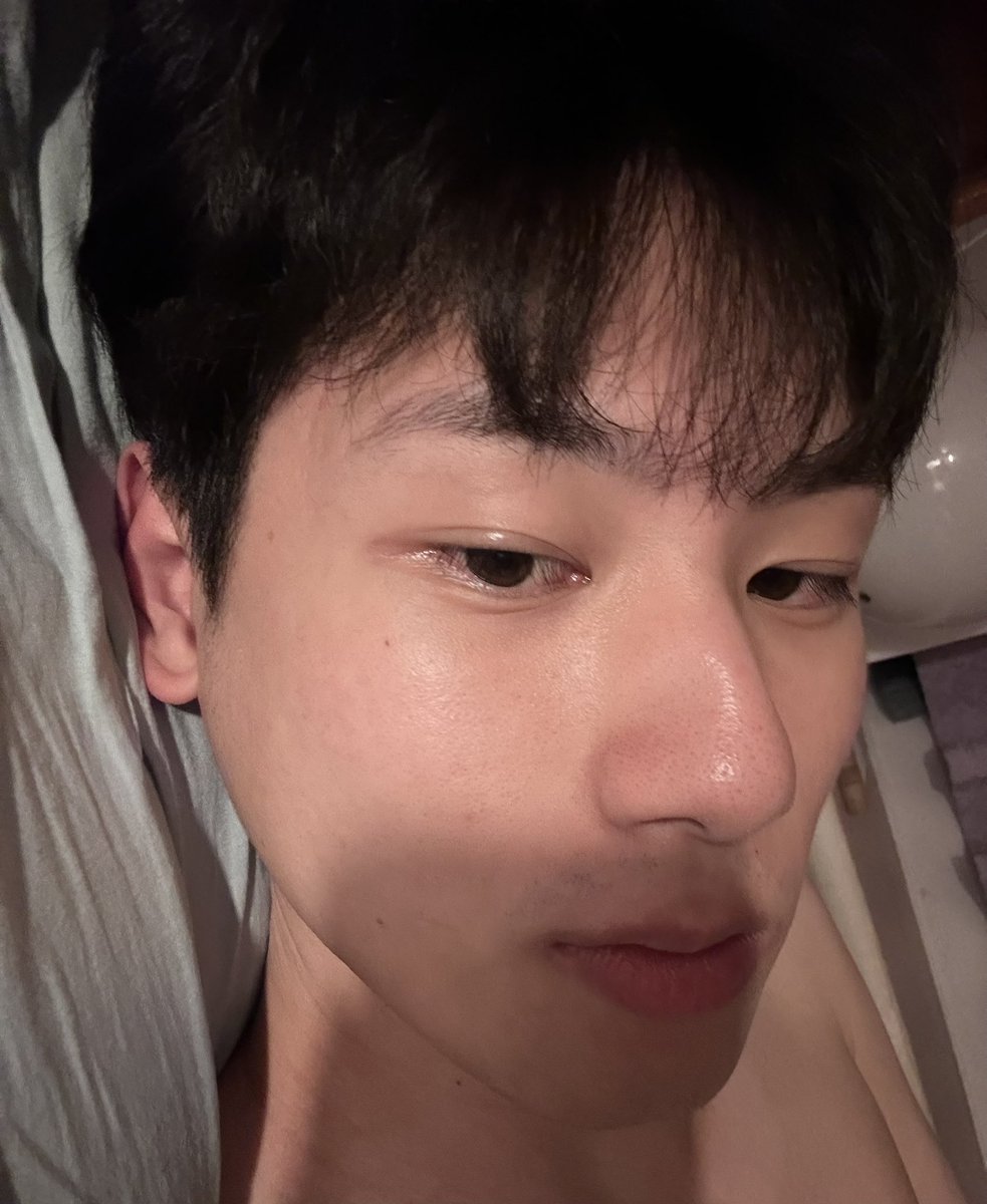 jhendese's tweet photo. 最近最開心的應該就是買到適合自己的保養品了吧 我的皮膚屬於敏感性肌膚 太乾會長痘所以之前都是吃A酸控制 吃了A酸嘴唇又會超乾 皮膚也是 現在臉整個超舒服🤩 https://t.co/CUtVJdYBdy