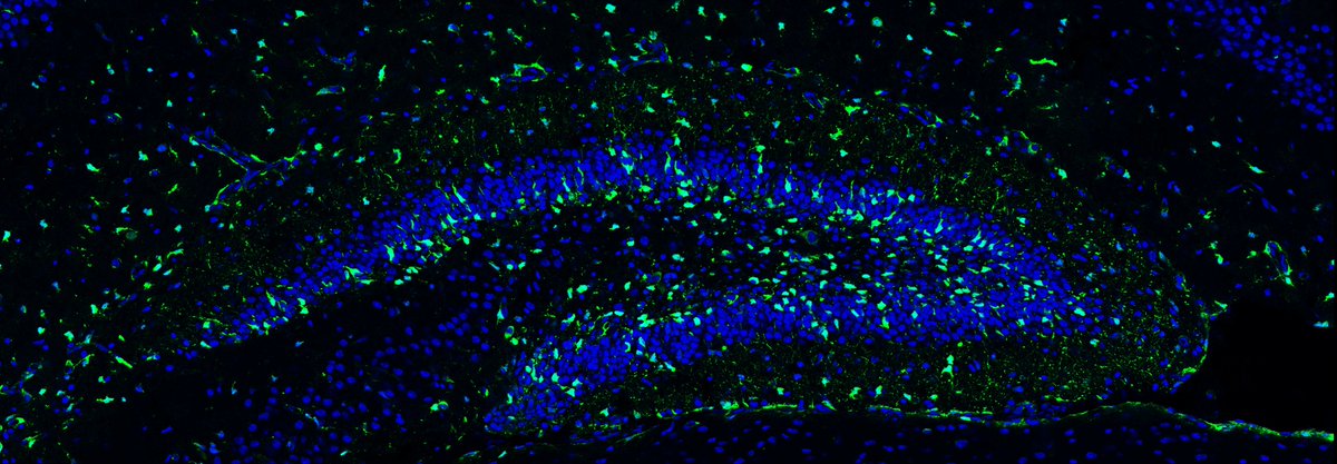 Allison Bond (@allisonmbond) on Twitter photo Introducing the official Bond Lab website: thebondlab.com
Interested in neural stem cell biology and a supportive training environment? The lab opens May 1 - come join us in NYC!
<a href="/IcahnMountSinai/">Icahn School of Medicine at Mount Sinai</a> <a href="/SinaiStemCell/">Mount Sinai Stem Cell</a> <a href="/SinaiBrain/">Friedman Brain Institute</a> <a href="/NewPI_Slack/">New PI Slack</a> Introducing the official Bond Lab website: thebondlab.com
Interested in neural stem cell biology and a supportive training environment? The lab opens May 1 - come join us in NYC!
<a href="/IcahnMountSinai/">Icahn School of Medicine at Mount Sinai</a> <a href="/SinaiStemCell/">Mount Sinai Stem Cell</a> <a href="/SinaiBrain/">Friedman Brain Institute</a> <a href="/NewPI_Slack/">New PI Slack</a>