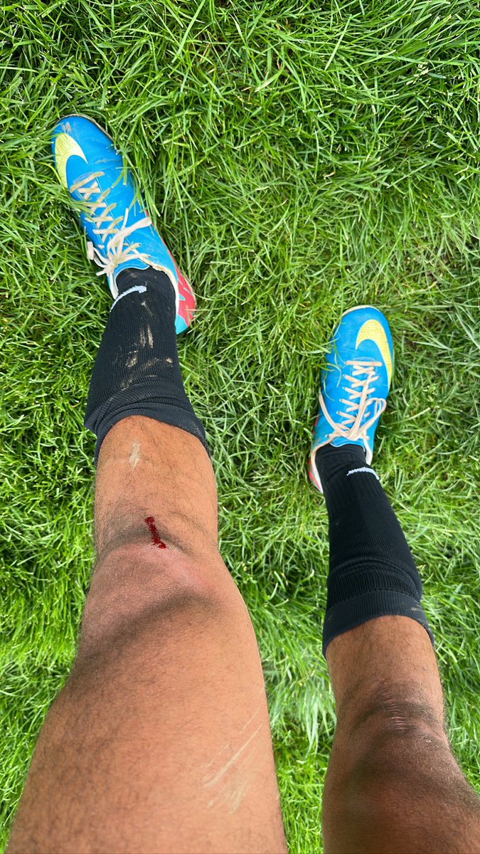 tyycolly's tweet photo. Scoring a goal in the last few minutes of the game makes the bloody knee worth it 😈 https://t.co/lr97PTfySv