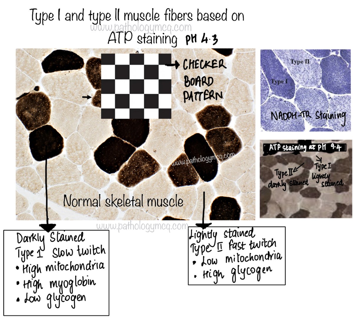 Pathology_mcqs's tweet photo. Type 1 and type II muscle fibers #normalhistology #normalmuscle #type1musclefiber #type2musclefiber #dmneuropathology #musculoskeletal #dmhistopathology #pathtwitter #pathboards #pathresidents #inicet #iniss #pathology #neurology https://t.co/bXG3EaLVxb