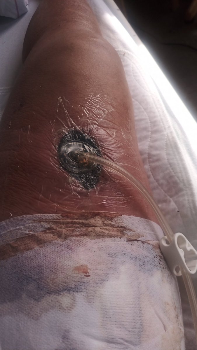 Vacuum pump.sucking.me.dry