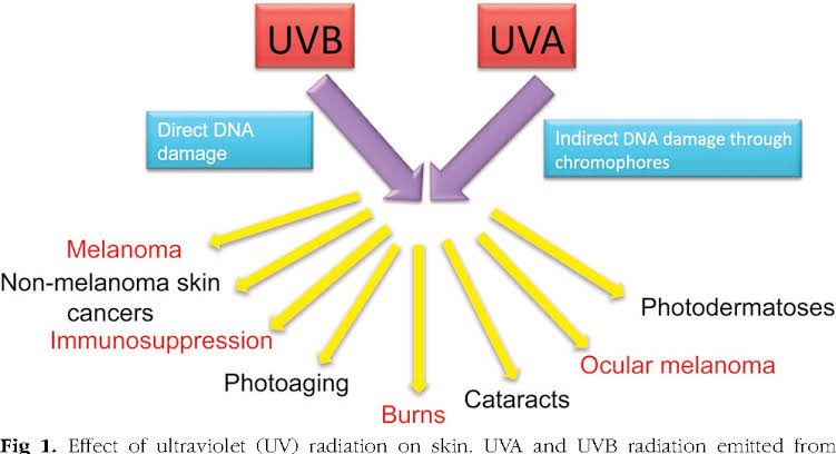 TheKoshurDoc's tweet photo. @OGdukeneurosurg @NEJM ◽️Unilateral Dermatoheliosis

▫️Dermatoheliosis : all changes to skin due to sun exposure

- Epidermis: Actinic keratosis
- Dermis: Solar elastosis
- Blood vessels: Telangiectasia
- Sebaceous glands: Solar comedones
- Melanocytes: Dffuse or mottled brown patches

@IhabFathiSulima https://t.co/3m49IrsoM8