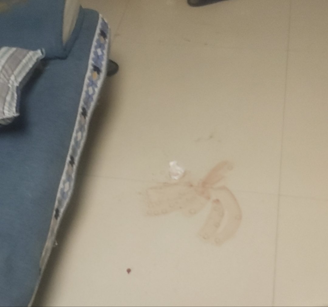 WindstopU's tweet photo. 啊 希望你们都可以开开心心
获得成就
自己用玻璃杯给自己头开了
达成（1/1） https://t.co/jnqmRSkGOn