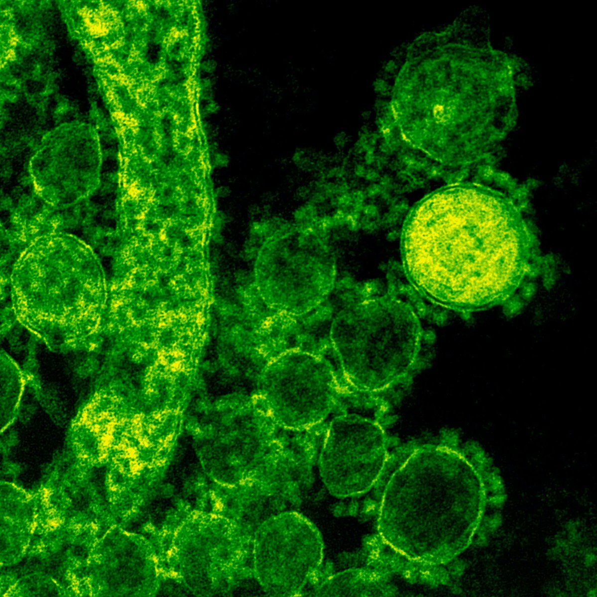 Unlock the future of age testing with #myDNAge 🧬 We offer the gold standard in epigenetic testing, empowering clinics and researchers worldwide. Inquire now: buff.ly/3GIv2re  

#epigenetictesting #biologicalage