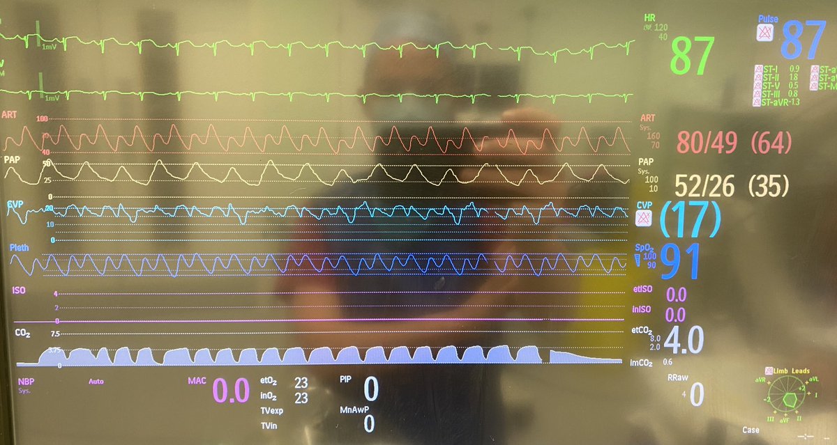 Andy Morley-Smith tweet media