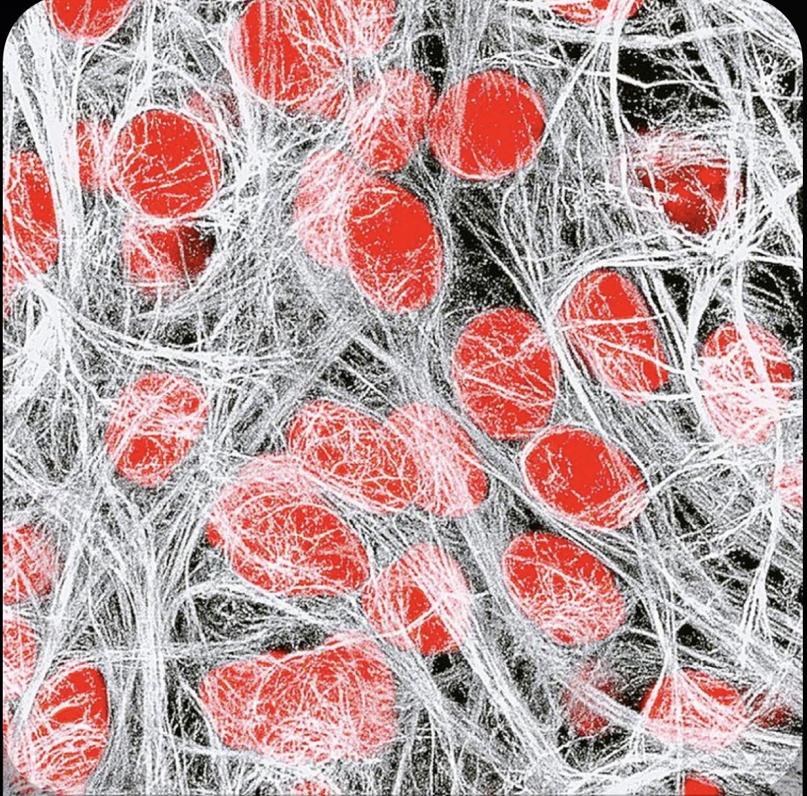 chrost_hugo's tweet photo. Brain tissue showing numerous glial cells and neurons.

Source: science photo library

#neuorscience https://t.co/GShLmsxkjQ