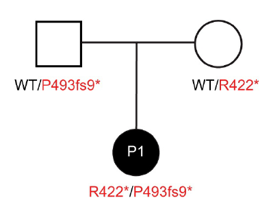 ZhiyongLiu7's tweet photo. 5/ We studied an otherwise healthy individual with HSE carrying compound heterozygous variants (R422*/P493fs9*) in RIPK3. This allows us, for the first time, to characterize the effects of #RIPK3 deficiency in humans. https://t.co/JXF1b2IQX6