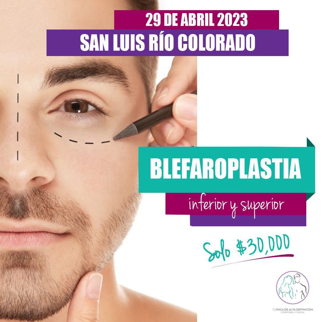 DefinicionC's tweet photo. Blefaroplastia https://t.co/wt7dpKuFWB