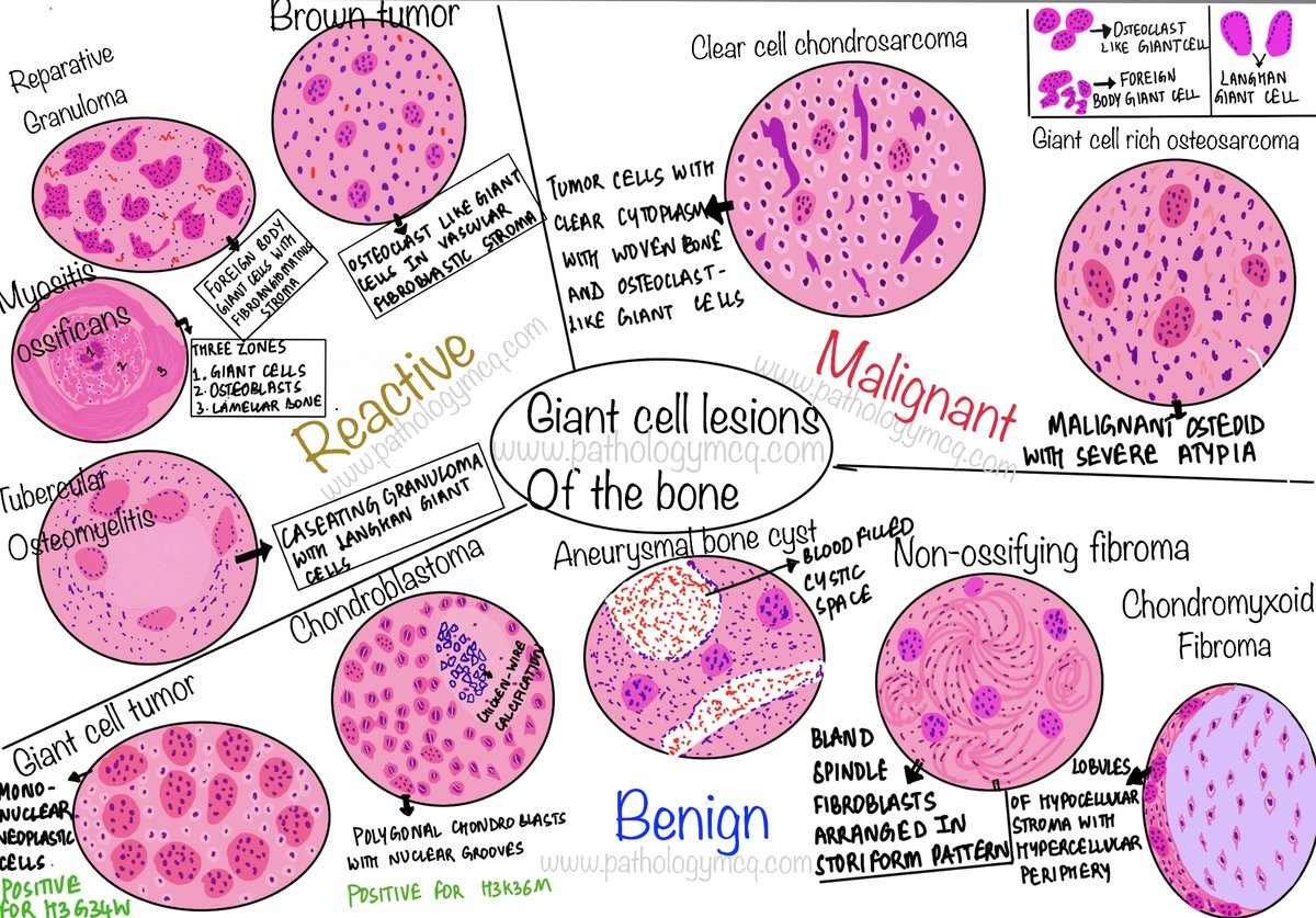 Differential diagnosis of giant cell lesions of the bone #giantcell #pathology #pathresidents #pathologyresidents #pathillustration #medicalillustration #medicalstudent #medicalschool #medicalstudents #studygram #tumor #pathologymcq #inicet #next #neetpg #PathTwitter