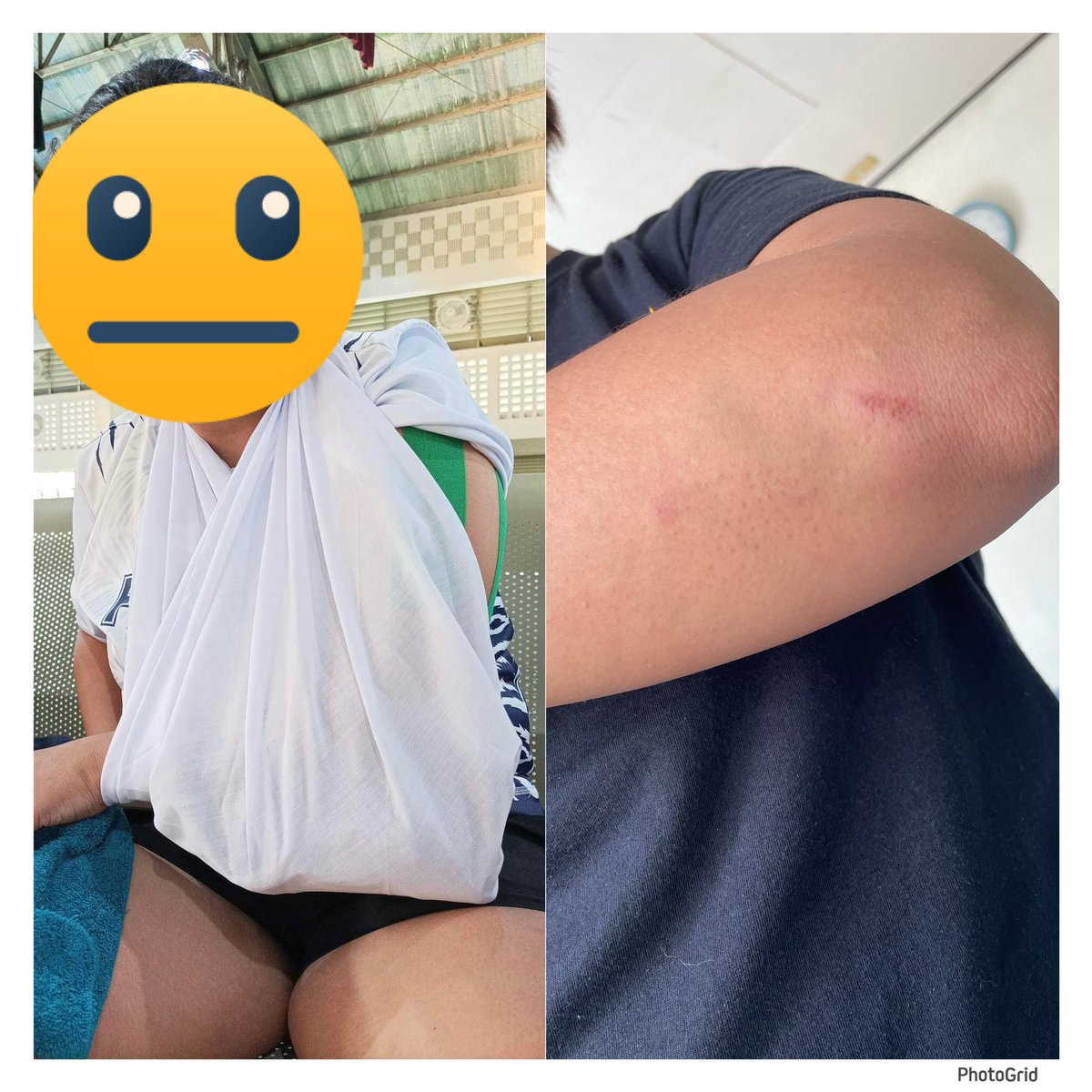 maradm14's tweet photo. i had a bad fall during our practice game last friday, but now i'm feeling better and ready to play again. 5 days to go ⛹️‍♀️ #PalarongUPLB2023 #TeamCAS #GoBlueTeam https://t.co/MEf4zHn846
