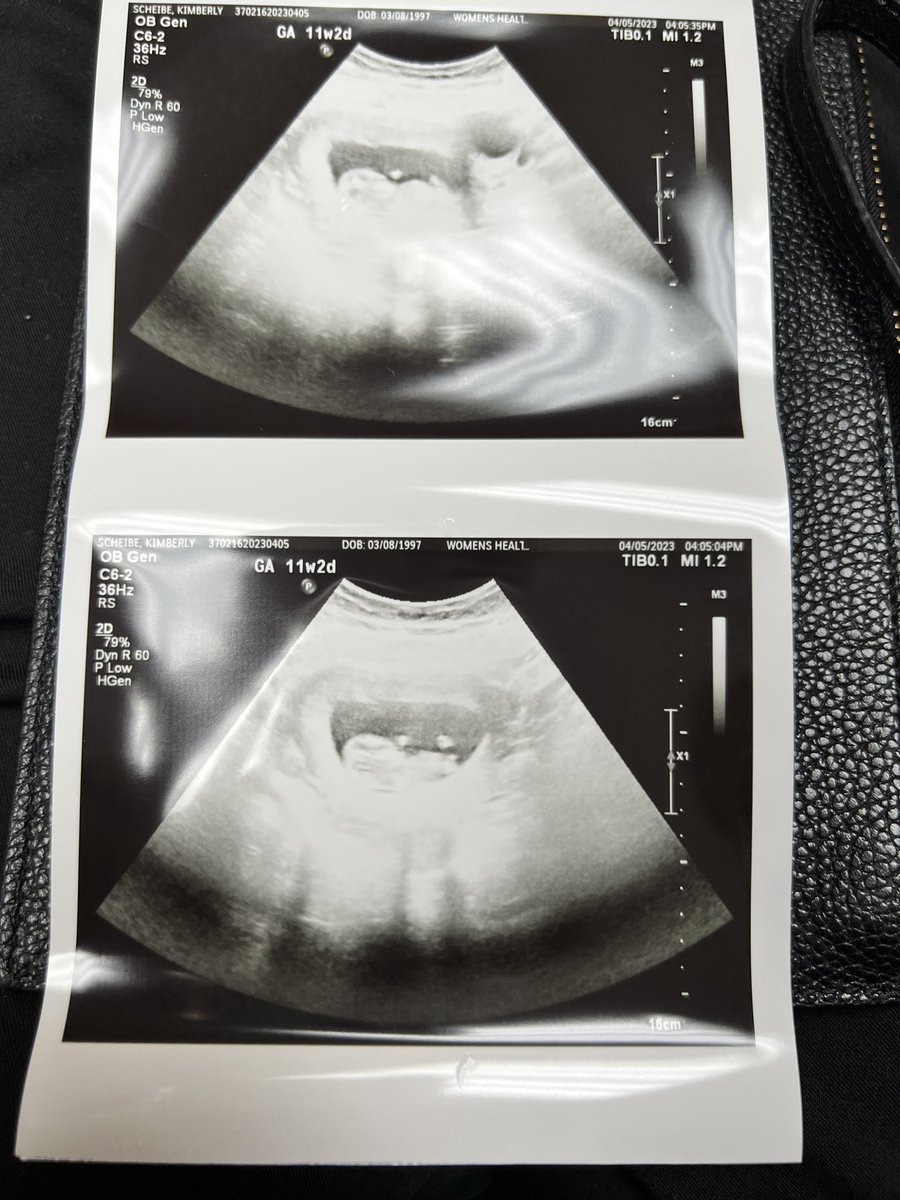 billyerne's tweet photo. Hi it’s me and I’m having a kid ❤️🥳 https://t.co/mr6qEc1wOs