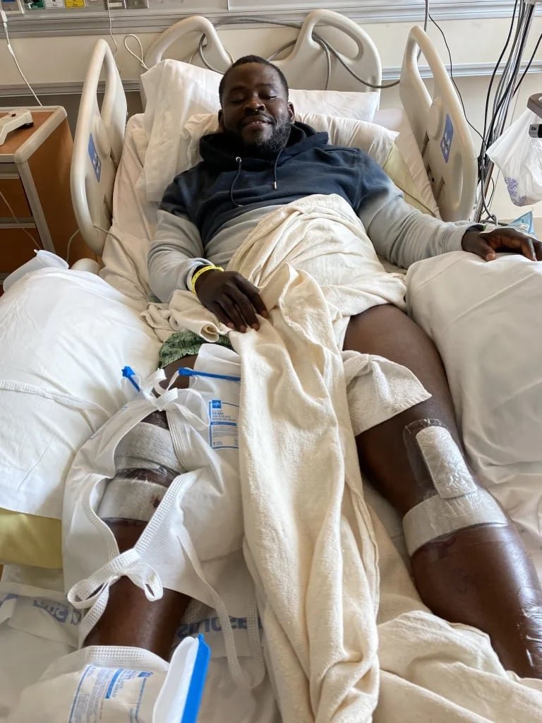 AcervoCharts's tweet photo. 🚨 EITA: Homem passa por cirurgia que envolveu a quebra dos ossos das pernas para aumentar a altura, a estatura do jovem foi de 1,65 para 1,78.

“Agora tenho uma namorada. Valeu a pena!” https://t.co/EmMEKSbIE6
