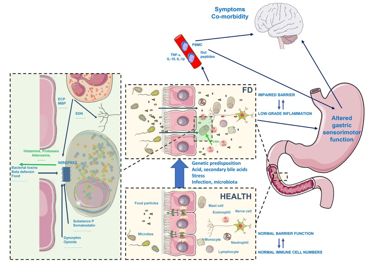 Please check out the excellent review @APandT, discussing the most recent discoveries on #FunctionalDyspepsia👏
👉Duodenum as a FD symptoms generator #GastroDuodenalDisorder #LowGradeDuodenalInflammation #ImpairedBarrierFunction
#AlteredGastricSensoryMotorFunction
👉What's next…