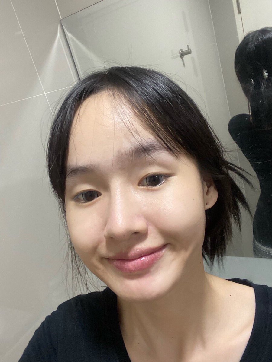 ผิวตอนนี้เลย ผิวแข็งแรงกว่าเดิมขึ้นเยอะมากกก จริงๆใช้ทุกตัวของแบรนด์เลย น่าจะเป็นปีแล้ว แบรนด์นี้ใช้ดีมากๆทุกตัว แบรนด์นี้เป็นแบรนด์ของออสเตรเลียเน้อ ปกติเค้าเป็นโรงงานผลิตยา พอทีหลังมาทำสกินแคร์ด้วย นี่แอบอยากลองอาหารเสริมของเค้าเลย รอนางเอาเข้าไทย5555