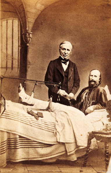 StoriaMedicina's tweet photo. The French surgeon Auguste Nélaton invented a porcelain-tipped probe that was able to distinguish the lead bullet from the bone in the case of gunshot wounds. It was used on two famous occasions concerning Giuseppe Garibaldi and Abraham Lincoln.

#histmed #surgery #historiamedica https://t.co/TX1gnmdzmM