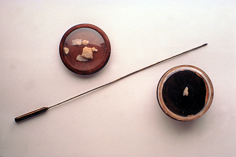 StoriaMedicina's tweet photo. The French surgeon Auguste Nélaton invented a porcelain-tipped probe that was able to distinguish the lead bullet from the bone in the case of gunshot wounds. It was used on two famous occasions concerning Giuseppe Garibaldi and Abraham Lincoln.

#histmed #surgery #historiamedica https://t.co/TX1gnmdzmM