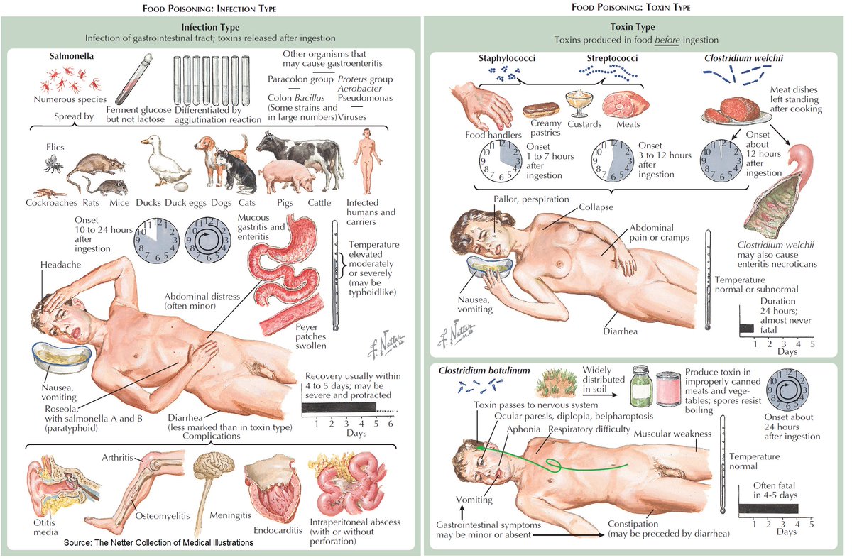 Food Poisoning - Infection and Toxin Type

#medtwitter #foamed #meded #usmle