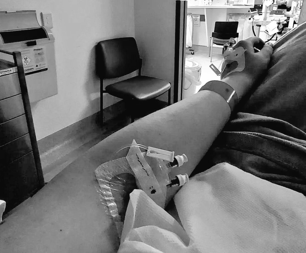 Vswildart's tweet photo. Pregnancy is trying to kill me again. Even though I haven't been pregnant for 2 weeks.
Actually in so much pain and doctors seem concerned. I'm a little scared and wish I was home with my baby. https://t.co/BVFmYCyHRU