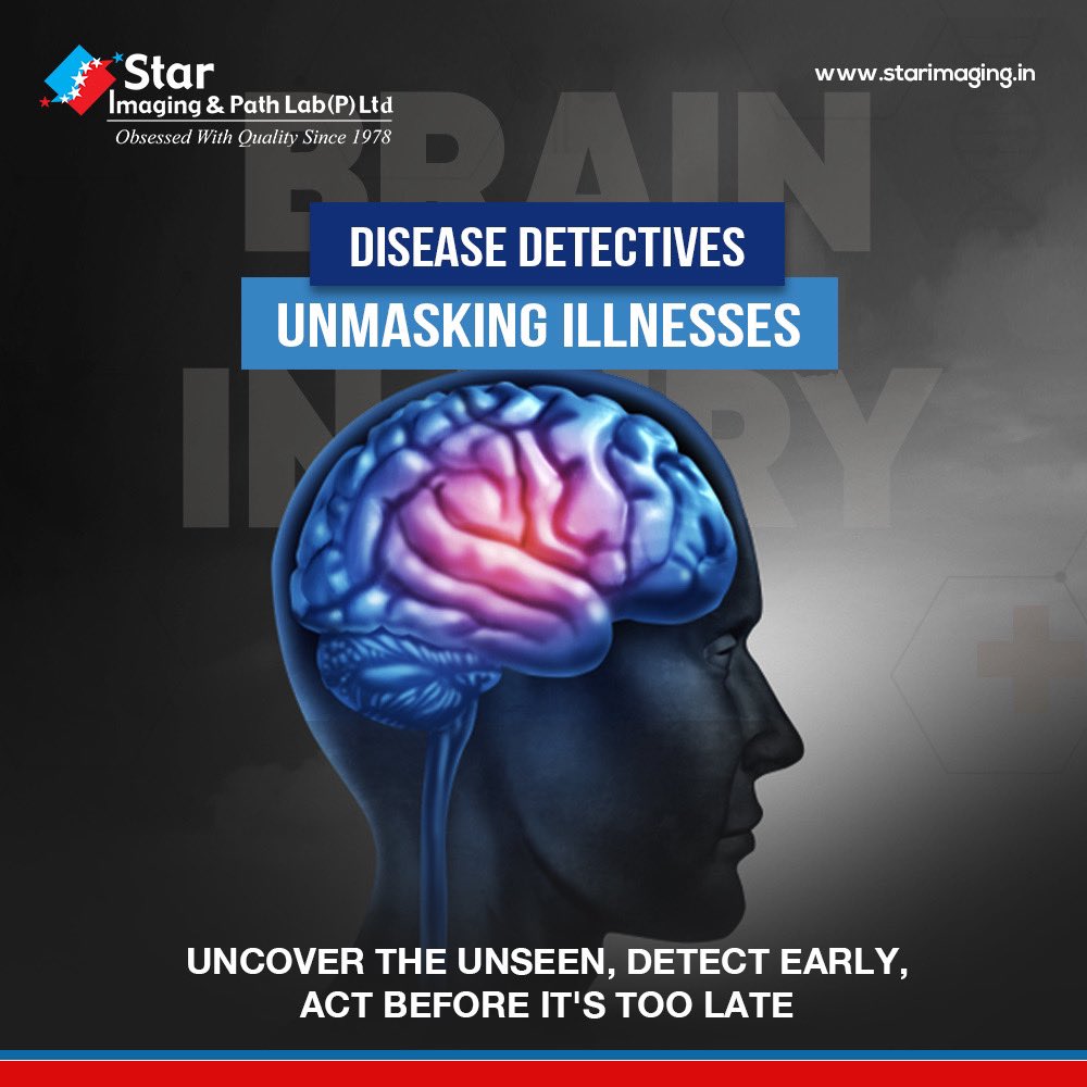 StarImaging_'s tweet photo. π¬ Unlock your brain's potential with Star Imaging and Path Lab! π§ Dive into the world of neuro-diagnosis and prioritize your neurological health π Book your appointment now! #NeuroDiagnosis #StarImaging #BrainHealth #PathLabExcellence #preventivehealth #diagnostics #pathlab https://t.co/fW6xaX1wBB