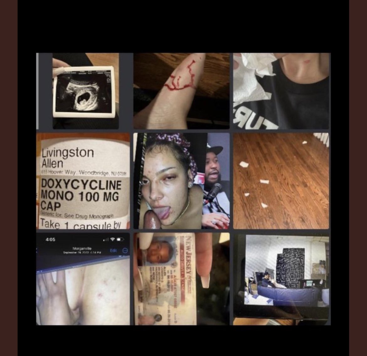 ShesFishy's tweet photo. DJ Akademiks’s girlfriend just exposed him for being abusive and having herpes in his discord server. https://t.co/BQ8Td4gdE4