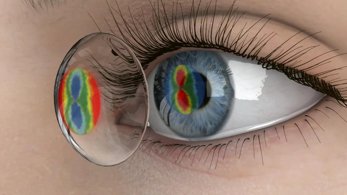 ow.ly/Komj104Eneb ow.ly/UvOu104EFH7 Communicating effectively with potential contact lens wearers - aop.org.uk