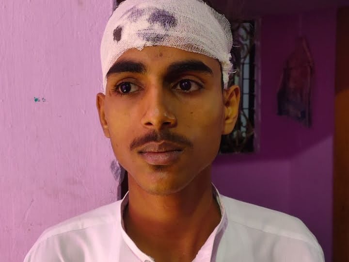 Delhiite_'s tweet photo. Stone peIted during Eid prayers in Allahabad
- Md Ebaad's got injured 
- police chased and caught the youth Yashwant Kr s/o Bachcha Lal
- FIR against three Yashwant Kr, Atul Kr, Rahul Maurya
https://t.co/CYZS338xXH https://t.co/4wvIopxVT6