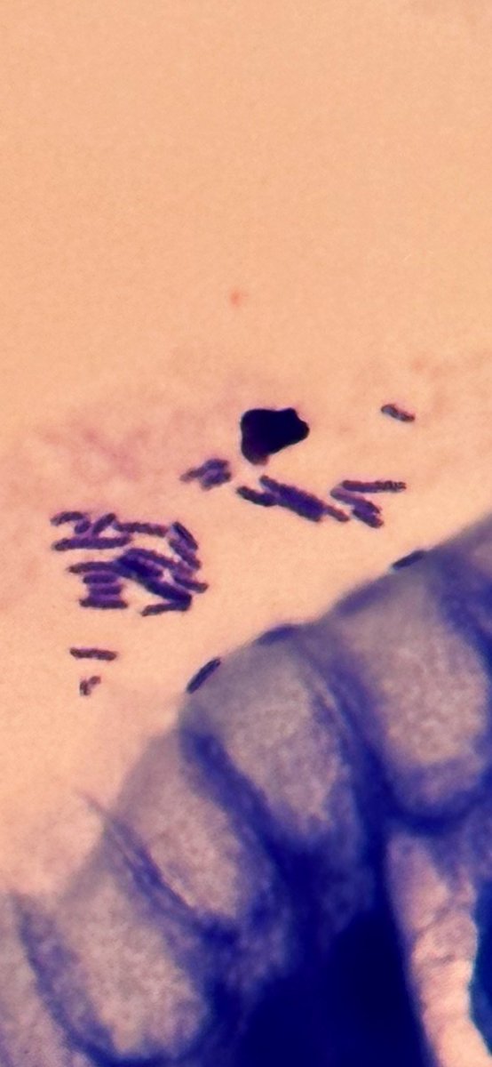 FrenchPath's tweet image. Guess the name of these bugs 🐞 
Hint : Giemsa coloration🔵
#pathbugs #pathology #Gipath