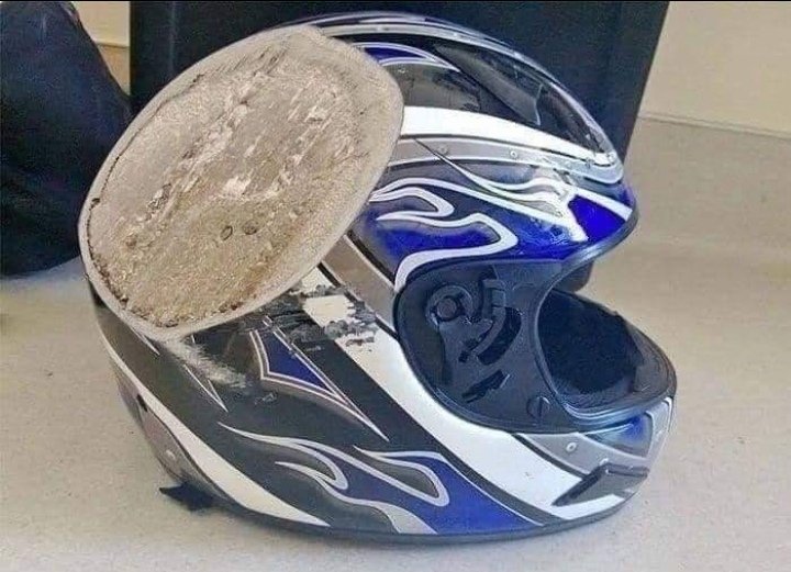 Manuelchiro254's tweet photo. Motorcycle Associated injuries are increasingly becoming a major cause for Orthopaedics/Surgical admissions.
To protect yourself from fatal head injuries, at least have this whenever you board/ride one. https://t.co/buIyad4KMC