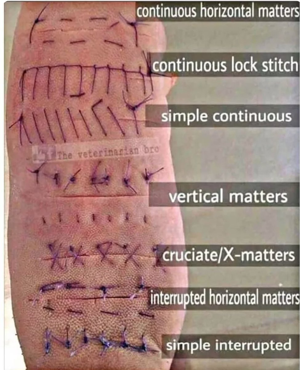 oren-gottfried-md-on-twitter-different-suture-techniques-with-thanks