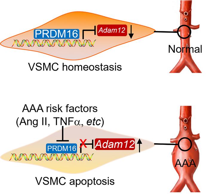 musclecellnews's tweet photo. ✨ In an exciting @JCI_insight study, a team of scientists show that PR domain-containing protein 16 deficiency (#PRDM16) in vascular smooth muscle cells aggravates abdominal aortic aneurysm (#AAA).

🤔 Find out how they arrived at this conclusion:
➡️ https://t.co/mBVEs27vQq https://t.co/6Hgo7wfazc