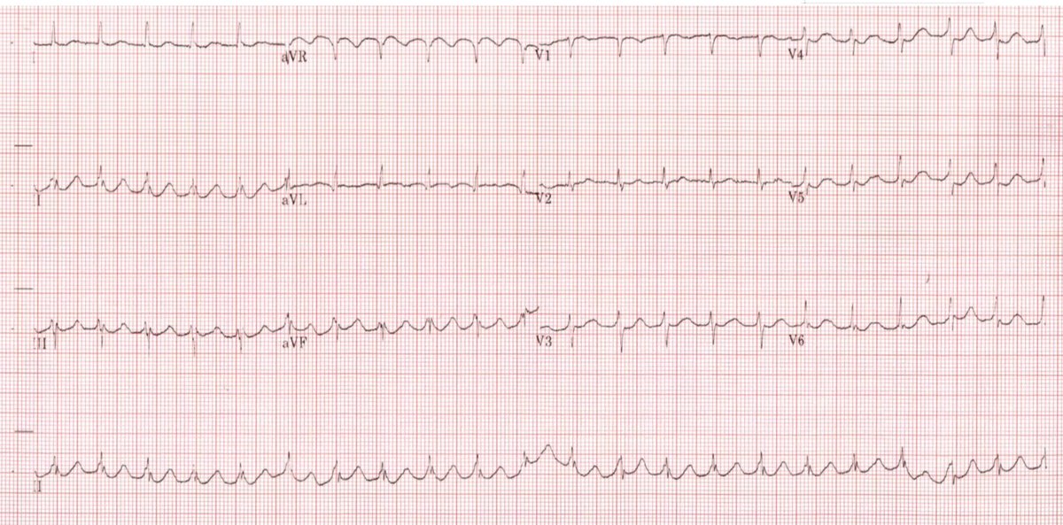 Mubarak Alhatemi tweet media