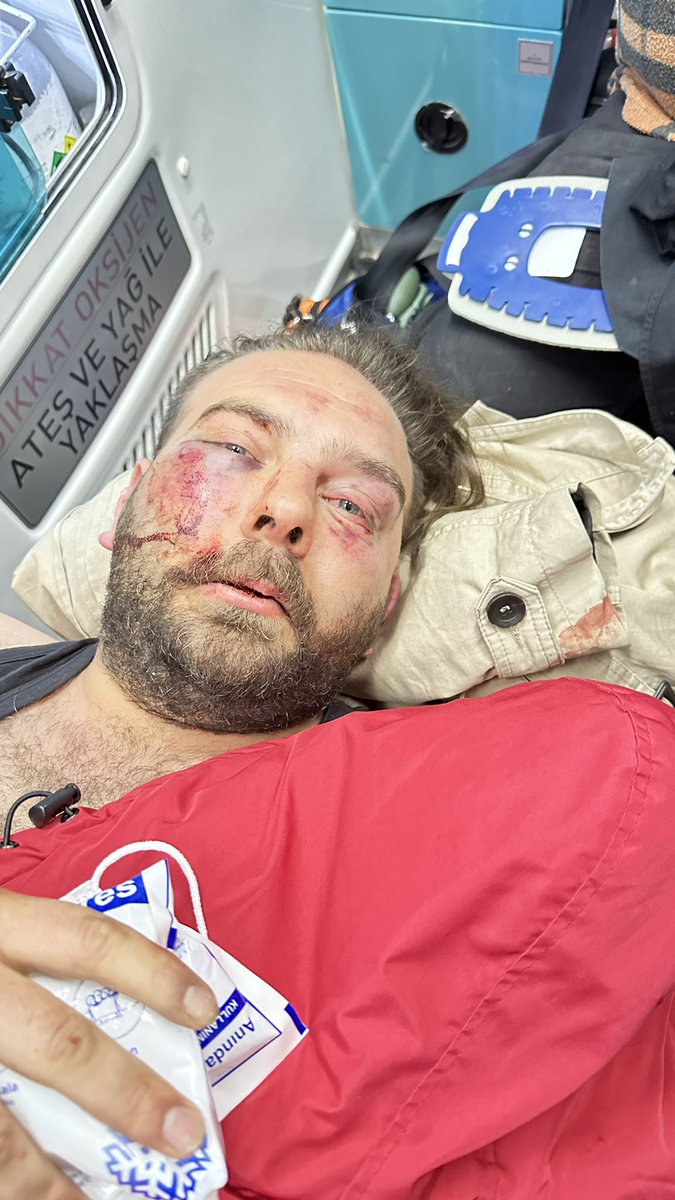 TolgaTurgut_06's tweet photo. Seçime kahpelik ve kan bulaştırdınız. Astırdığınız afişleri söken Sincan Gençlik Kolu Başkanımız Osman Çağatay Ayrıçal ‘ a saldıran @06melihgokcek denen müptezelin adamlarıdır. 
Emin ol bu burda kalmayacak. https://t.co/OJ0lvCOgCT