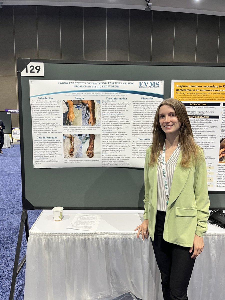 So excited to have gotten the opportunity to share my research with Dr. @DerberCatherine on V. Vulnificus nec fasc at #ACP2023 Thank you @ACPIMPhysicians !!