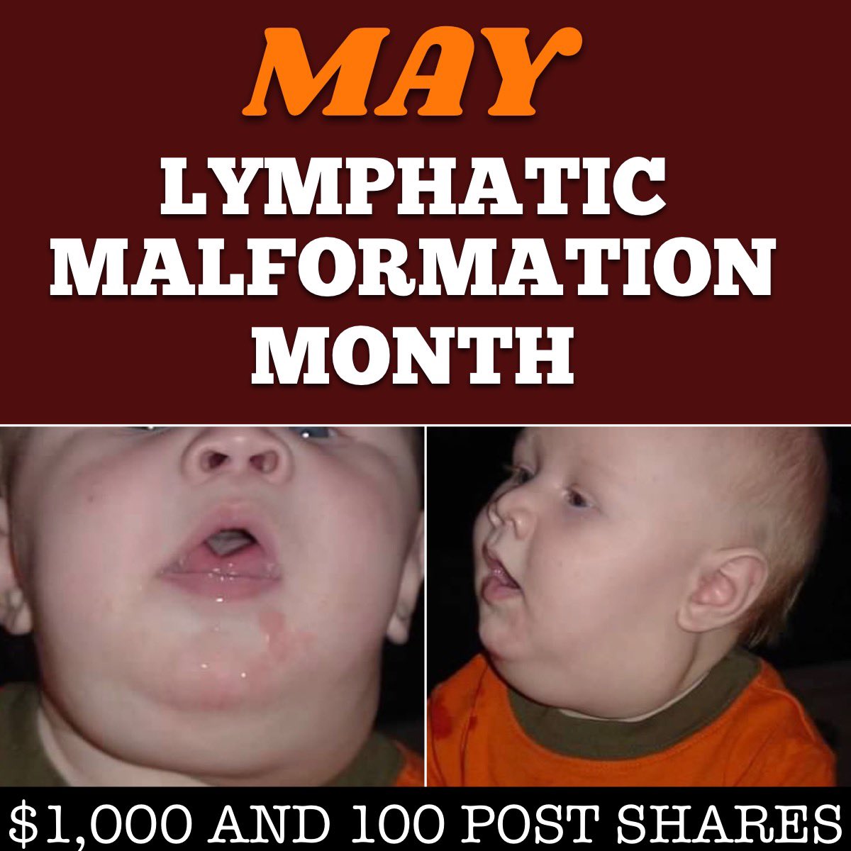 Zac’s Attack for a Cure tweet media