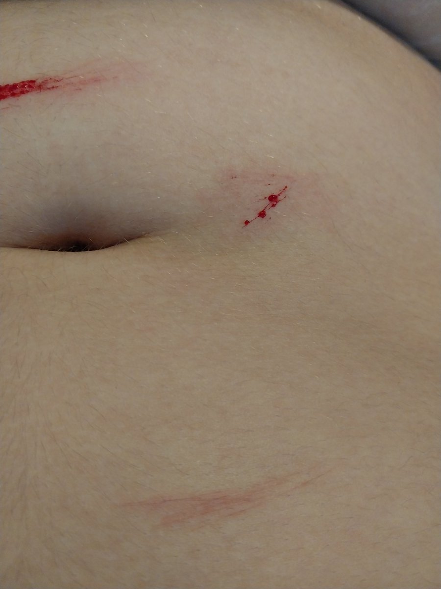 lov3slvt's tweet photo. I ❤ cutting my stomach Tw:sh https://t.co/WSGan7q1Tz