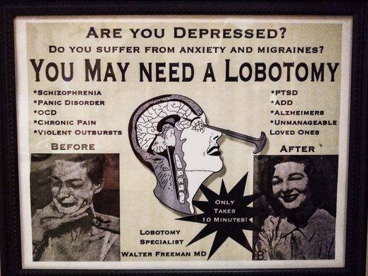 DrEliDavid's tweet photo. “The science was settled”, and the inventor of lobotomy received the Nobel Prize for medicine in 1949.

The science is never settled. Never blindly trust the experts, and never “believe in science”. https://t.co/My30CSNnOm
