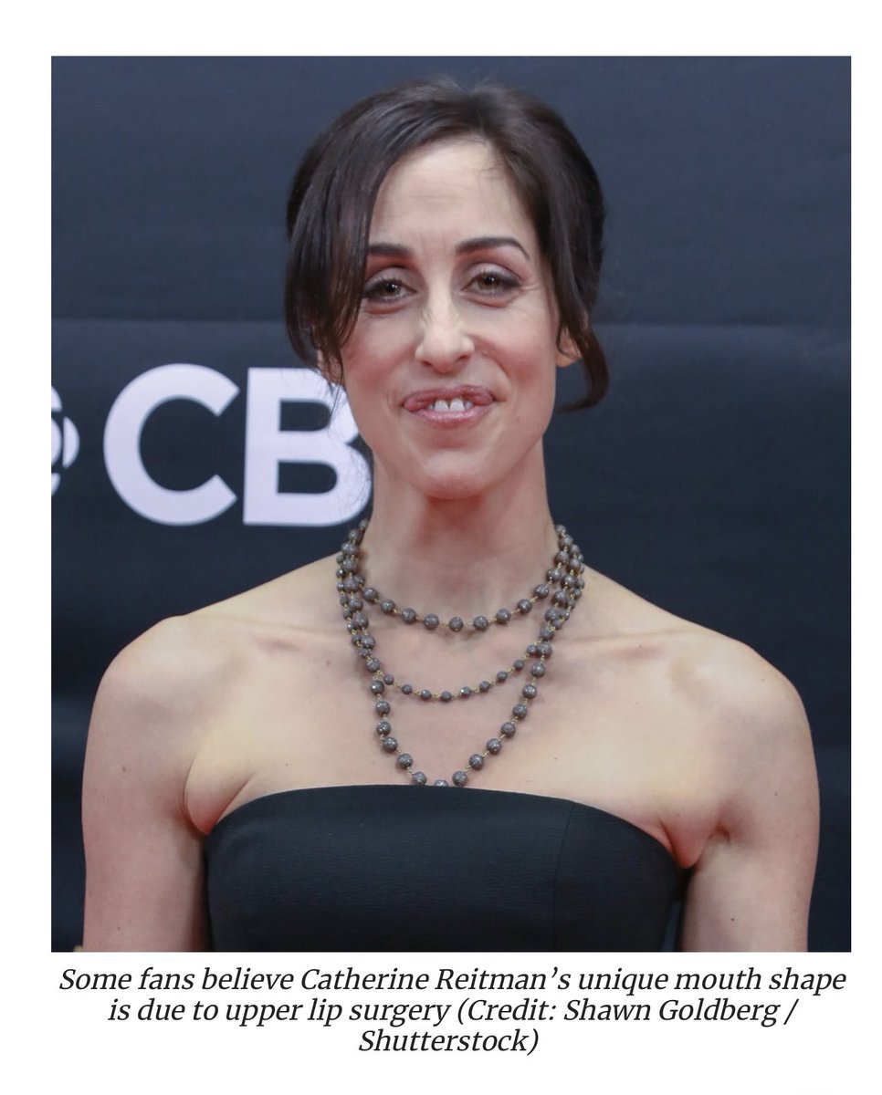 Kims_Quest's tweet photo. I love Working Moms and Catherine Reitman. Curiosity got the best of me and I googled her lips. Claims have been made no lip surgery but I can’t help but think lips looked like the botched silicone injections. Lisa Rinna had that same thing if I remember correctly. https://t.co/3P6bpaW0PX