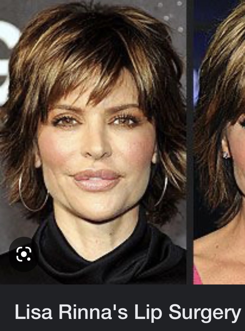 Kims_Quest's tweet photo. I love Working Moms and Catherine Reitman. Curiosity got the best of me and I googled her lips. Claims have been made no lip surgery but I can’t help but think lips looked like the botched silicone injections. Lisa Rinna had that same thing if I remember correctly. https://t.co/3P6bpaW0PX