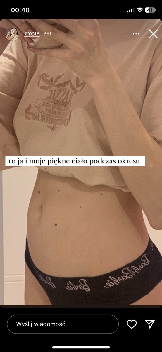 xxmirtillo's tweet photo. Alexsis Ola chciała być Julią Machunik, ale Julia Machunik robi to dobrze 🤍 https://t.co/ELJlpjqr8p