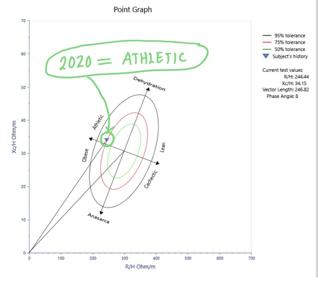 fmashili's tweet image. "🌟 Level up your #WellnessWeek with body composition tracking! 💪 Ditch weight &amp;amp; BMI, focus on bioimpedance phase angle &amp;amp; BIVA. 📊 Phase angle reveals cellular health &amp;amp; integrity, while BIVA classifies you beyond BMI - from obese to athletic! 🏋️‍♂️🏃‍♀️ #BeyondBMI #BodyComposition