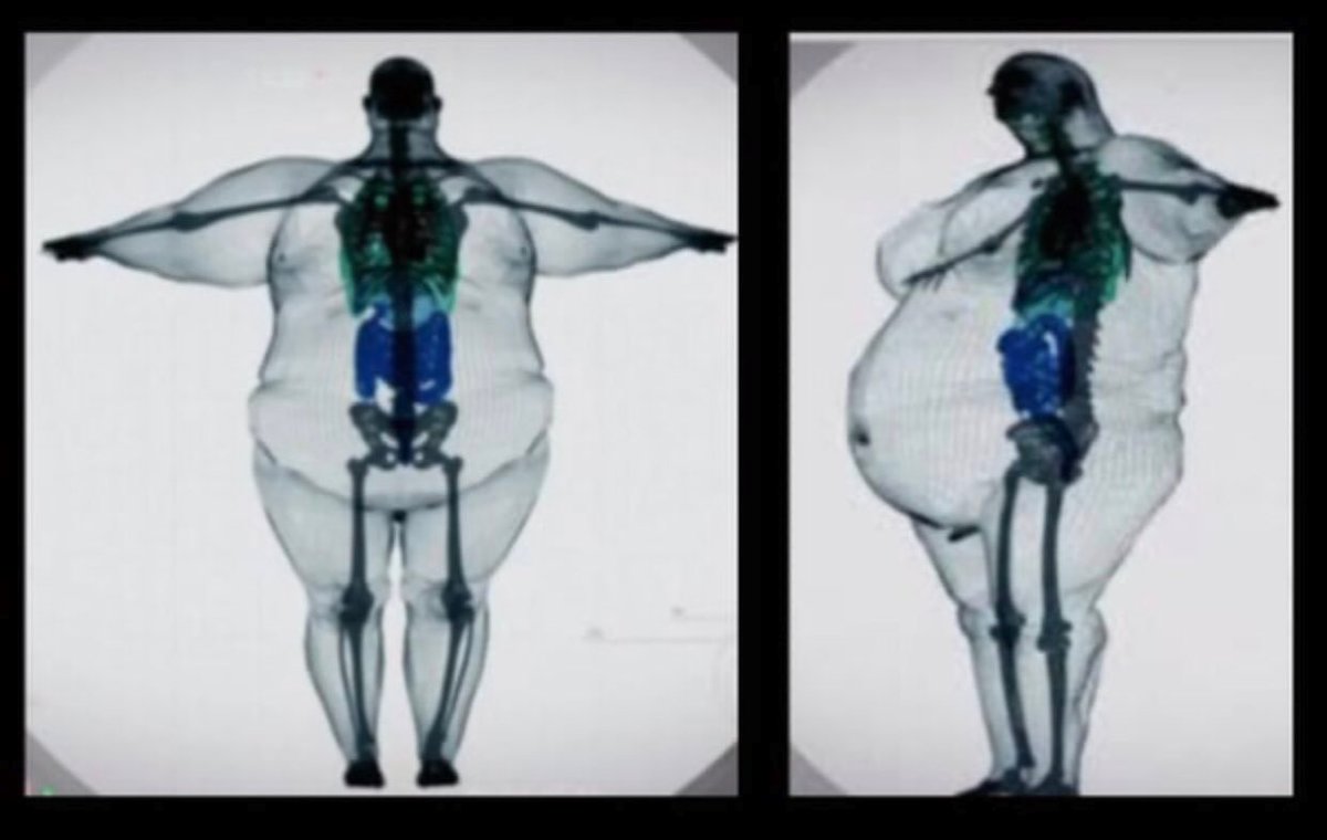 estherckrakue's tweet photo. "Big boned" https://t.co/p7EiDClSVy