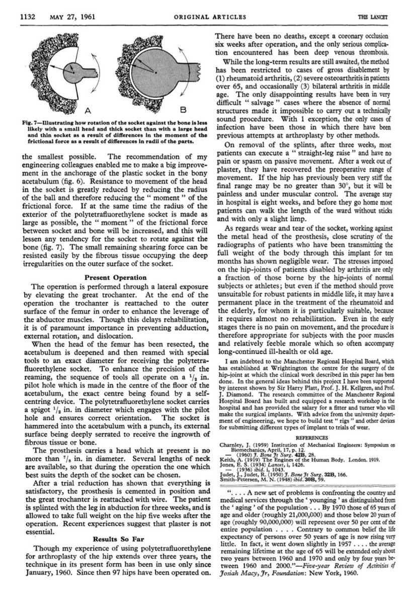 MoAImam's tweet photo. Here is the original 1961 publication by John Charnley published in @TheLancet .....a monumental piece of arthroplasty history. The Charley Hip replacement from @wrightington16 #orthotwitter https://t.co/3HWap6IhwX