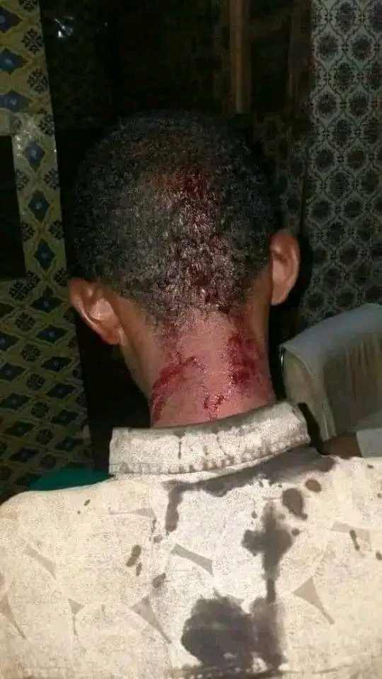 ABDIFATAHHASSE4's tweet photo. The Ethiopian army massacred innocent civilians today in Godey #Ogaden. https://t.co/8oXy0CPxBX