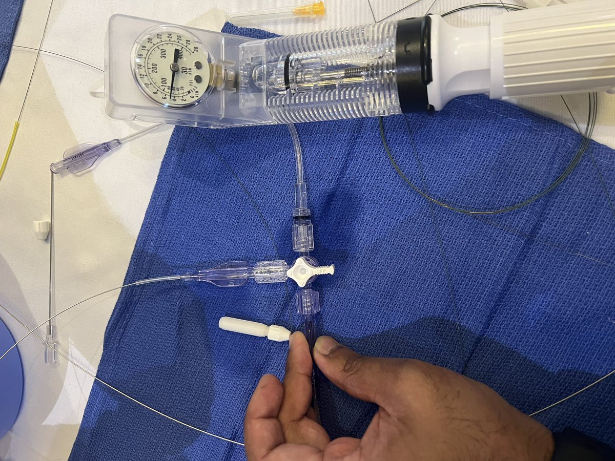 DrJayMohan's tweet photo. My favorite “Pintoism” from @duanepinto this weekend
“I only created this so I can be antisocial”
Rotating Stopcock ➕male to male➕two indeflators 🟰 one operator antisocial kissing balloon inflation
#PCImasters @ekgpdx @kevinjamescroce @KateKearney4 @jason_wollmuth @esbrilakis