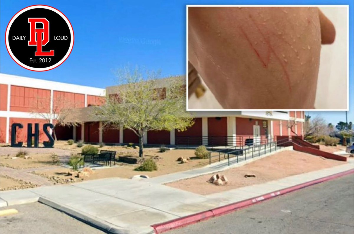 Autistic Jewish teen was attacked and had a swastika carved on his back at Las Vegas high school 😔