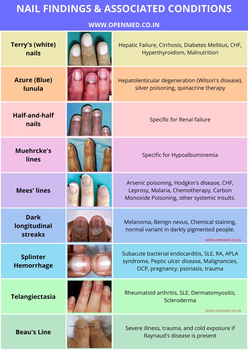 Nail Findings & Associated Conditions Change in color, ... | GrepMed