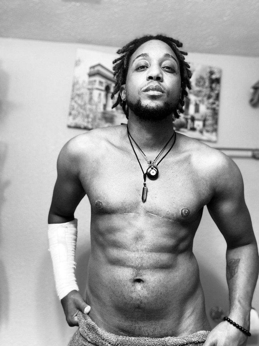 thorprototype's tweet photo. 4 months post-op 🏳️⚧️😈😘🧿💫🖤 #transmen #transmenofcolor #secondstagecomingsoon #hysterectomy #topsurgery #bottomsurgery #phalloplastystageone #transmenaremen https://t.co/byeE1SesIP